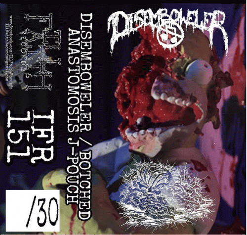 Botched Anastomosis J-Pouch : Disemboweler - Botched Anastomosis J-Pouch